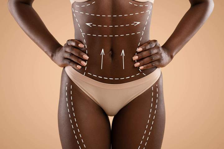 Soins amincissants Guadeloupe